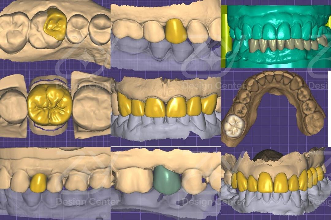 The Quiet Revolution in Your Dentist's Chair