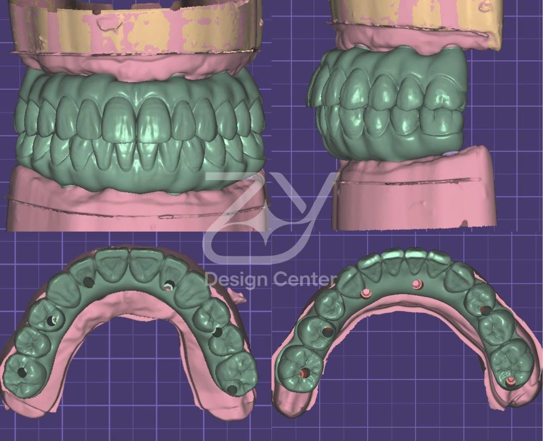 The Quiet Revolution in Your Dentist's Chair