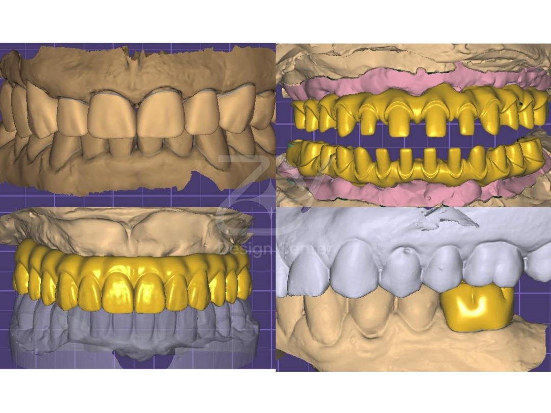 The Quiet Revolution in Your Dentist's Chair