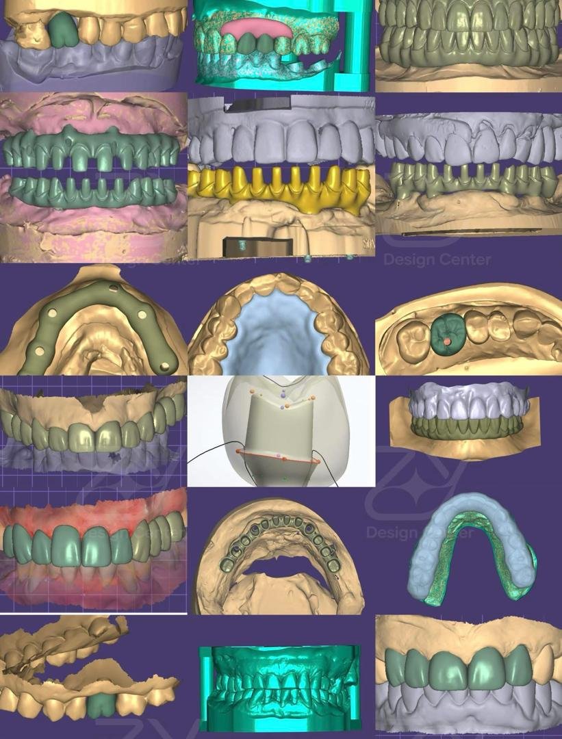 The Quiet Revolution in Your Dentist's Chair